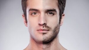 Köselik nedir, nasıl tedavi edilir?